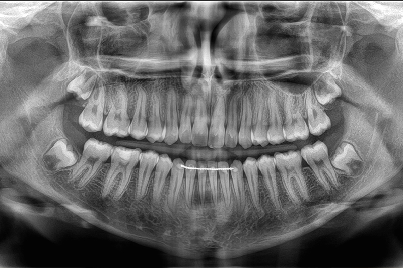 Pano in Pembroke Pines