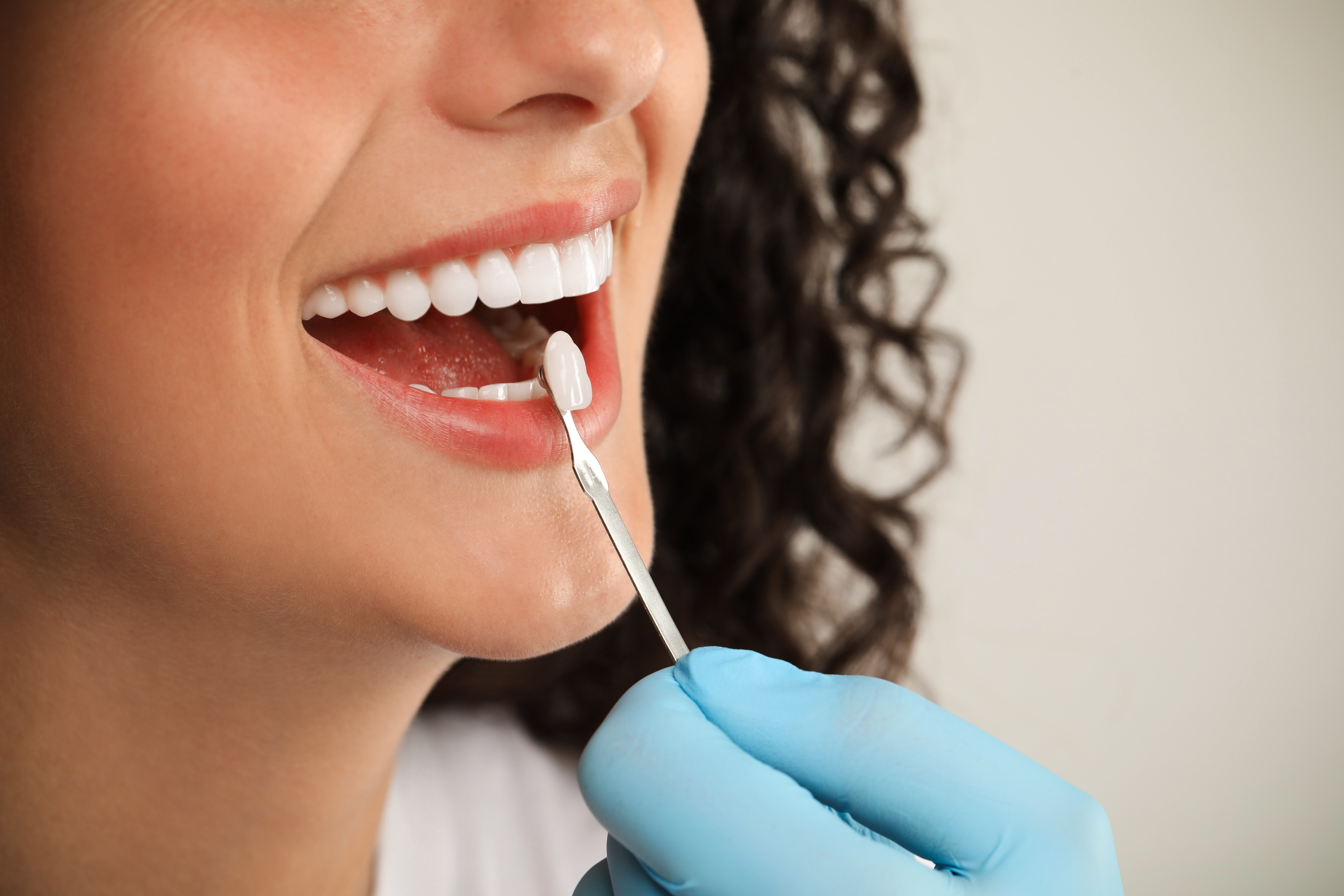 Quality Dental Treatments in Pembroke Pines